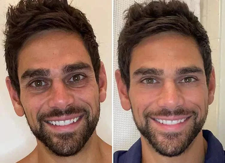 SAAM - Young & Radiance Serum (Original)