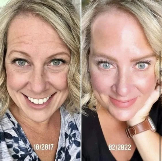 SAAM - Young & Radiance Serum (Original)