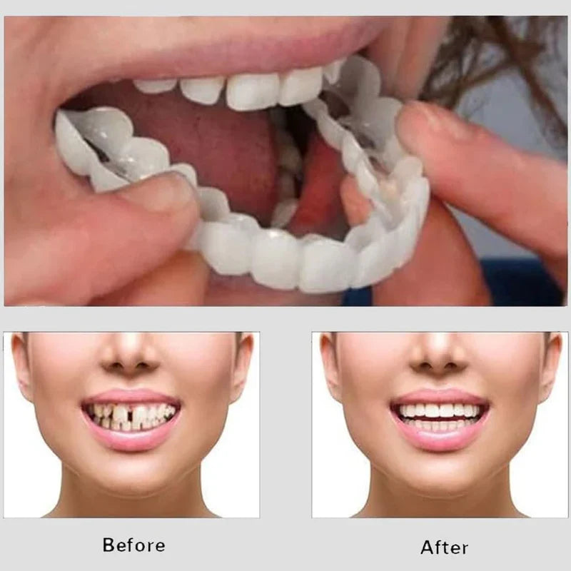 Removable White Teeth Veneers Covers Gaps, Yellow, Missing & Crooked Teeth - One Size Fits All, No Dentist Needed