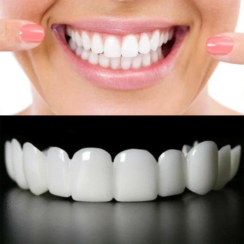 Removable White Teeth Veneers Covers Gaps, Yellow, Missing & Crooked Teeth - One Size Fits All, No Dentist Needed